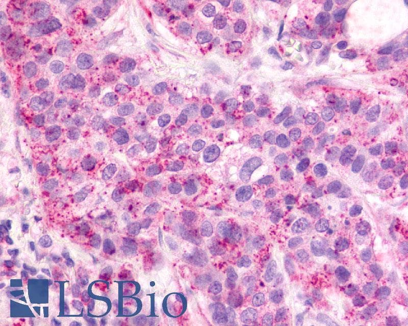 IHC-plus™ CXCR2 Antibody (N-Terminus)