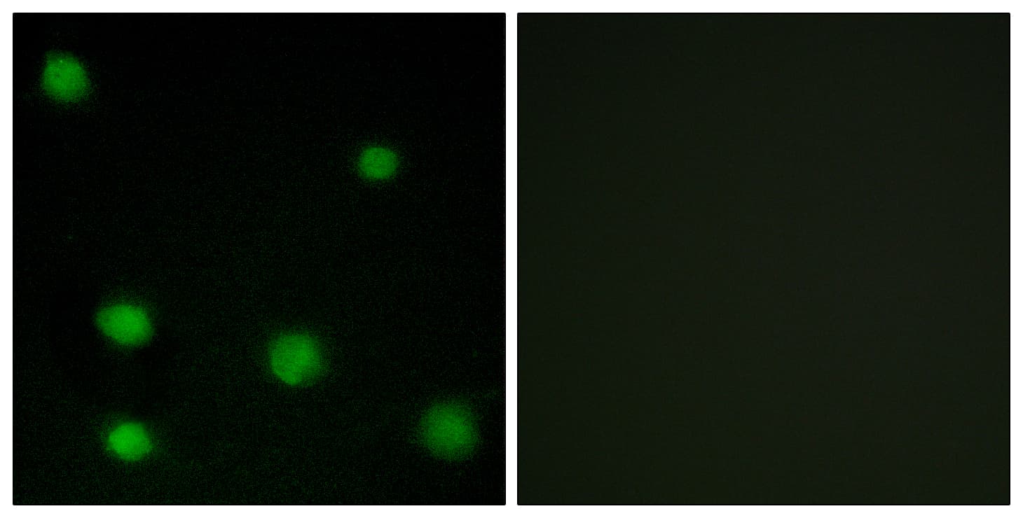Polyclonal Rabbit anti-Human RBM6 / 3G2 Antibody (aa991-1040, IHC, IF, WB)