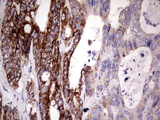 Monoclonal Mouse anti-Human PDSS2 / DLP1 Antibody (clone UMAB177, Carrier-free, IHC, WB)