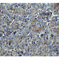 MAGEA4 Antibody