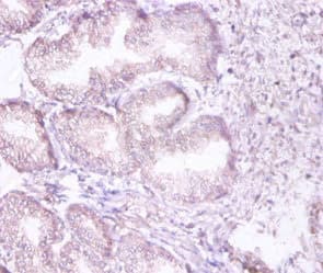 PSMD11 Antibody