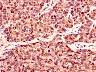 CSNK2B / Phosvitin Antibody