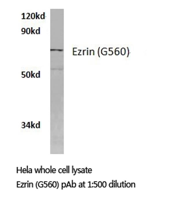 EZR / Ezrin Antibody (Gly560)