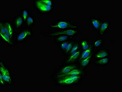 Polyclonal Rabbit anti-Human PPP6C Antibody (IHC, IF)