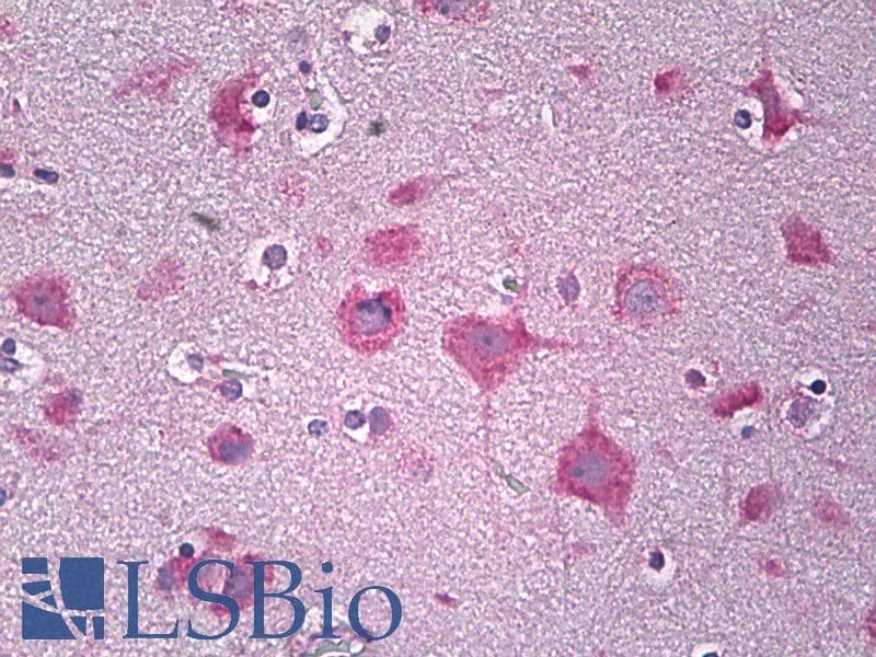 IHC-plus™ PARD3 Antibody (aa1141-1190)
