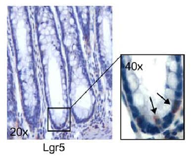 GPR49 / LGR5 Antibody (aa250-550, clone OTI2A2)