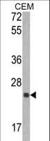 TIMP1 Antibody (aa41-70)