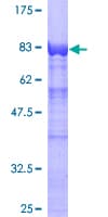 Human SYNCRIP / HnRNP Q Protein (Recombinant GST)