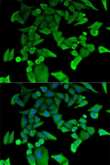 TPT1 / TCTP Antibody