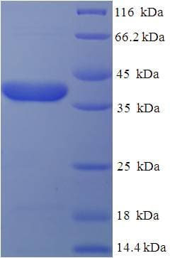 Human EBAG9 / RCAS1 Protein (Recombinant His-SUMO)