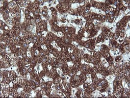 ACAA2 Antibody (clone OTI3C6)