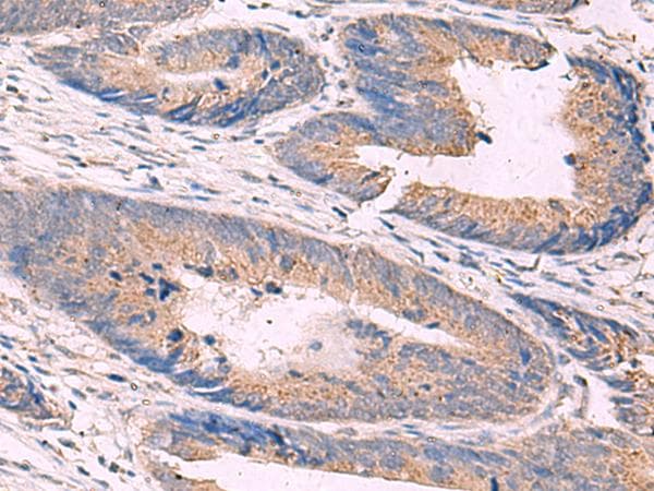 KCNN3 / SK3 Antibody