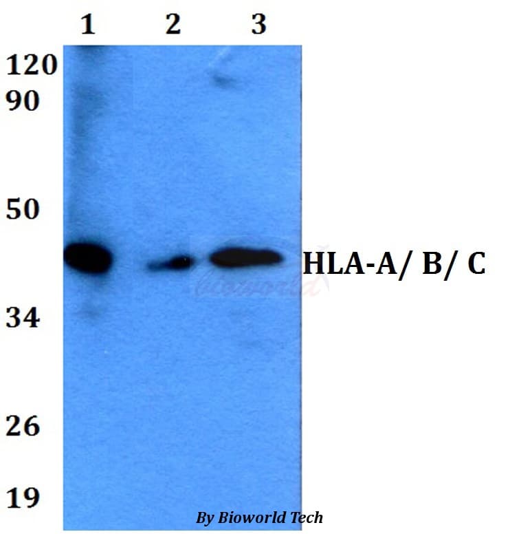 HLA-A/B/C Antibody