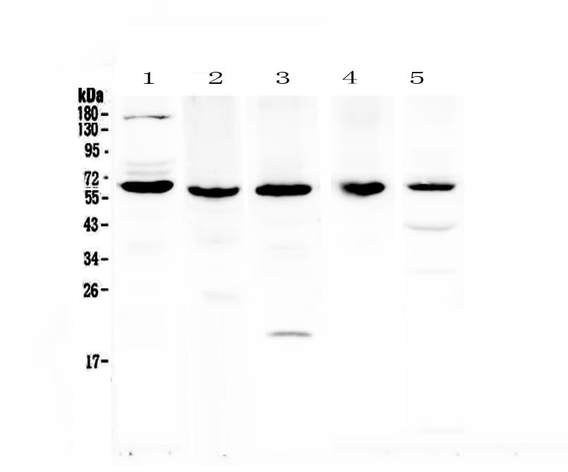 Polyclonal Rabbit anti-Human TRAF3 Antibody (WB)