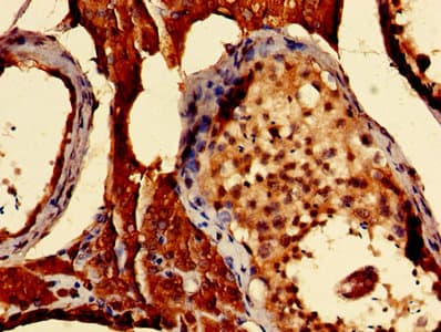 Polyclonal Rabbit anti-Human S100A16 Antibody