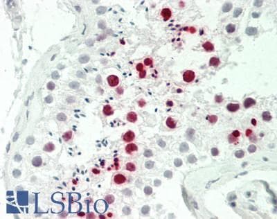 IHC-plus™ CLK2 Antibody (N-Terminus)
