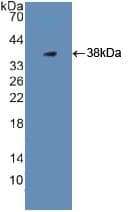 PLG / Plasmin / Plasminogen Antibody (aa274-560)