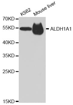 ALDH1A1 / ALDH1 Antibody