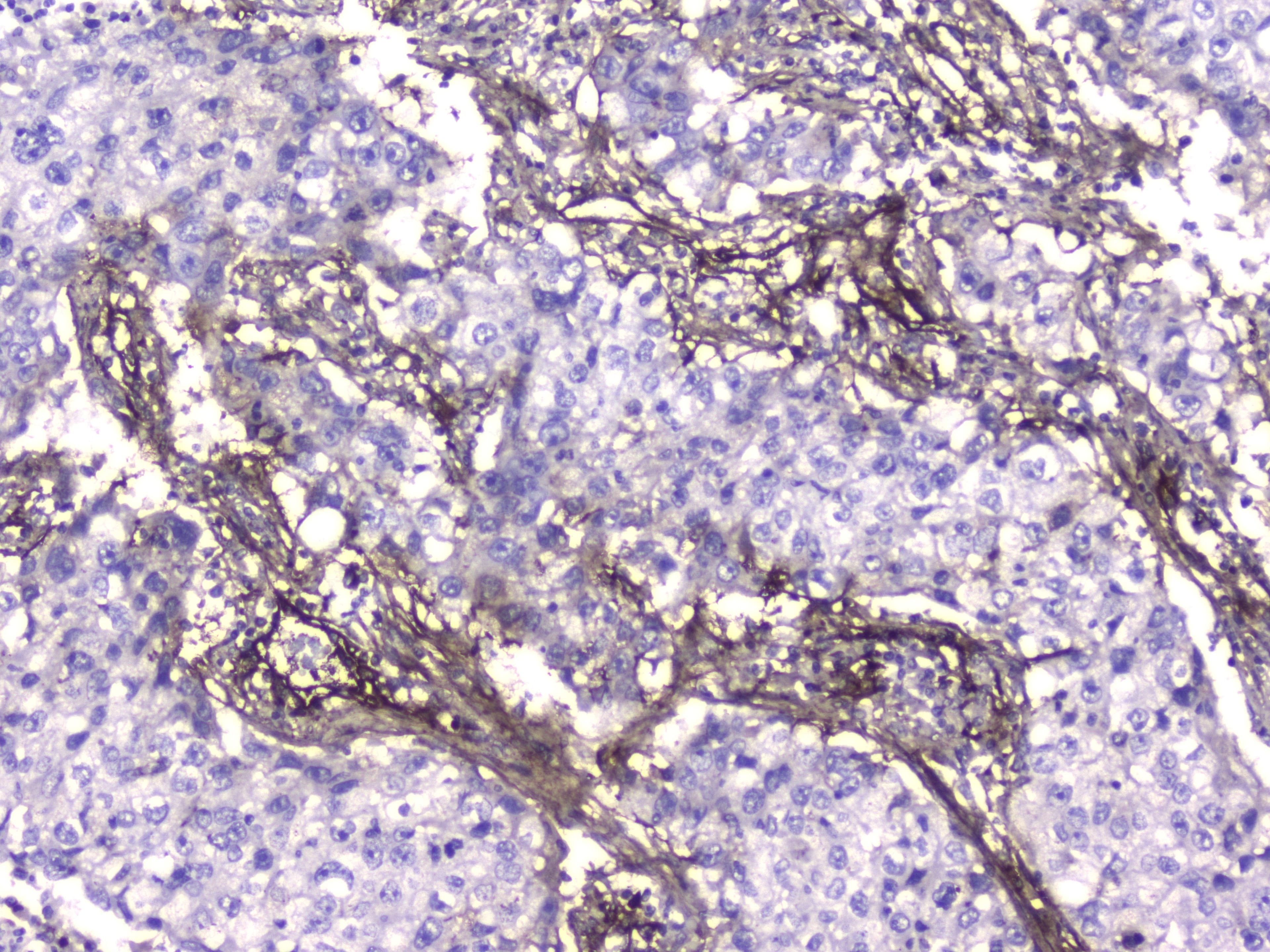 COL4A1 / Collagen IV Alpha1 Antibody