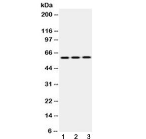 KRT14 / CK14 / Cytokeratin 14 Antibody