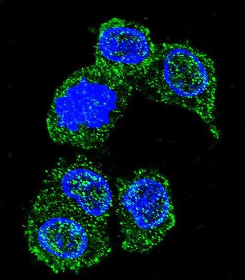 MAPK8 / JNK1 Antibody (aa358-389)