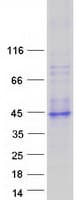 Human L3 / LASS2 Protein (Recombinant Myc-DDK (Flag))
