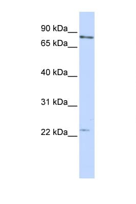 MAD2L1 / MAD2 Antibody (C-Terminus)