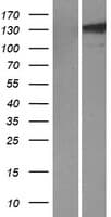TLL1 Protein (Over-Expression Lysate Myc-DDK (Flag))