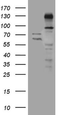 ZNF217 Antibody (aa730-1048, clone OTI2B1)