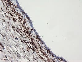 F13A1 / Factor XIIIa Antibody (clone 1H2, Carrier-free)