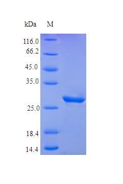 Human IGFBP5 Protein (Recombinant)