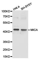 Polyclonal Rabbit anti-Human MICA Antibody (IHC, WB)
