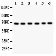 PRKCI / PKC Iota Antibody (aa21-214)