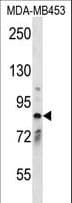 CNNM2 Antibody (aa646-674)
