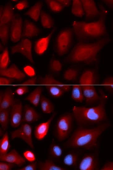 Polyclonal Rabbit anti-Human PDLIM5 / LIM Antibody (IHC, IF, WB)