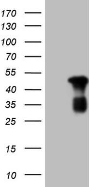 RB1 / Retinoblastoma / RB Antibody (aa309-590, clone OTI10H9)