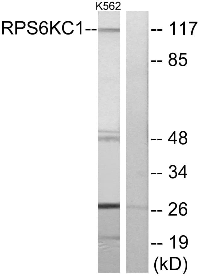 IHC-plus™ Polyclonal Rabbit anti-Human RPS6KC1 Antibody (aa231-280, IHC, IF, WB)