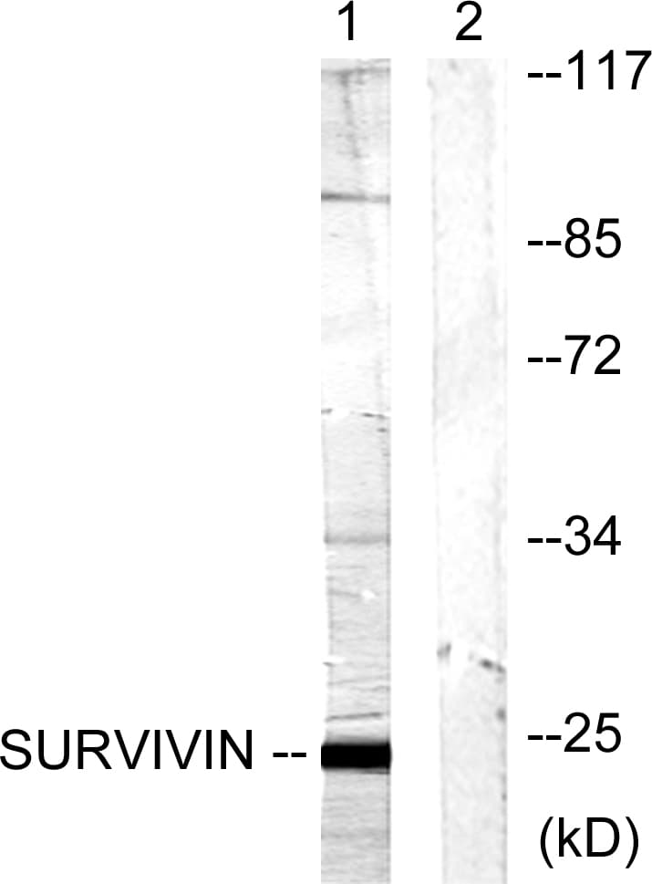 PathPlus™ Polyclonal Rabbit anti-Human BIRC5 / Survivin Antibody (aa86-135, IHC, IF, WB)