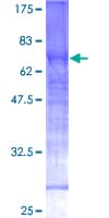Human CDK4 Protein (Recombinant GST)
