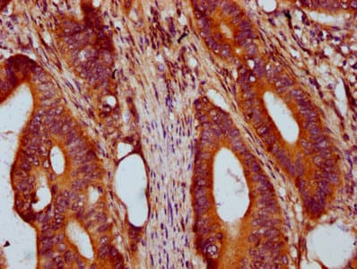 PRSS16 Antibody