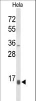 Polyclonal Rabbit anti-Human NPW Antibody (aa121-150, WB)