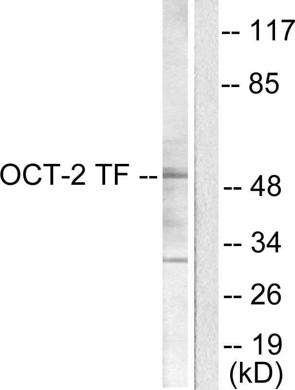 POU2F2 / OCT2 Antibody (aa1-50)