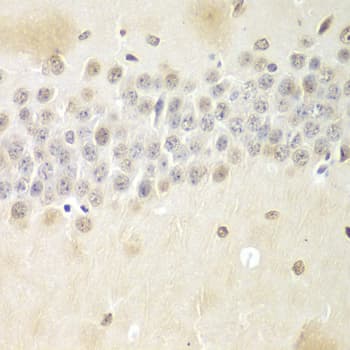 Polyclonal Rabbit anti-Human NONO / P54NRB Antibody (IHC, IF, WB)