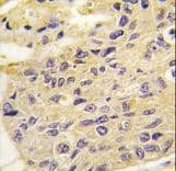 Polyclonal Rabbit anti-Human FRAT1 Antibody (aa99-128, IHC, WB)