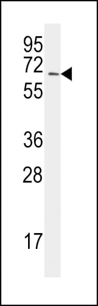 Polyclonal Rabbit anti-Human SAE2 / UBA2 Antibody (aa601-631, IHC, WB)