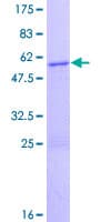 Human ZBED3 Protein (Recombinant GST)