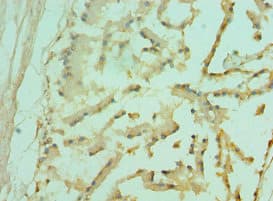 Polyclonal Rabbit anti-Human FOXP2 Antibody (aa416-715, IHC)