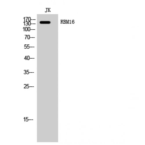 Polyclonal Rabbit anti-Human SCAF8 Antibody (550-630 aa, Internal, WB)