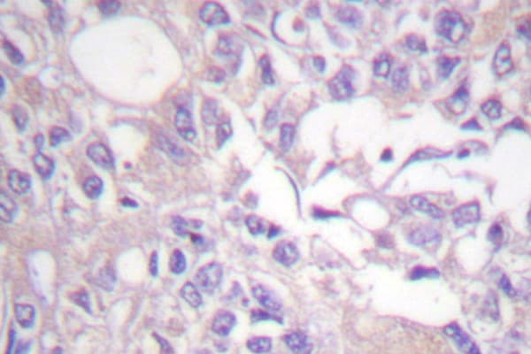 TH / Tyrosine Hydroxylase Antibody (Gly13)