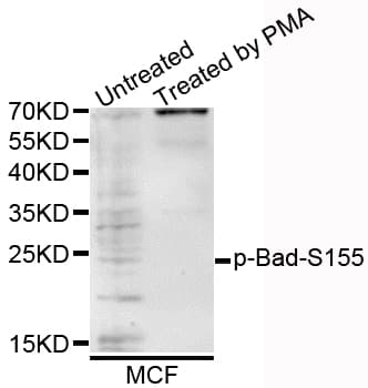 Polyclonal Rabbit anti-Human BAD Antibody (phospho-Ser118, IHC, WB)